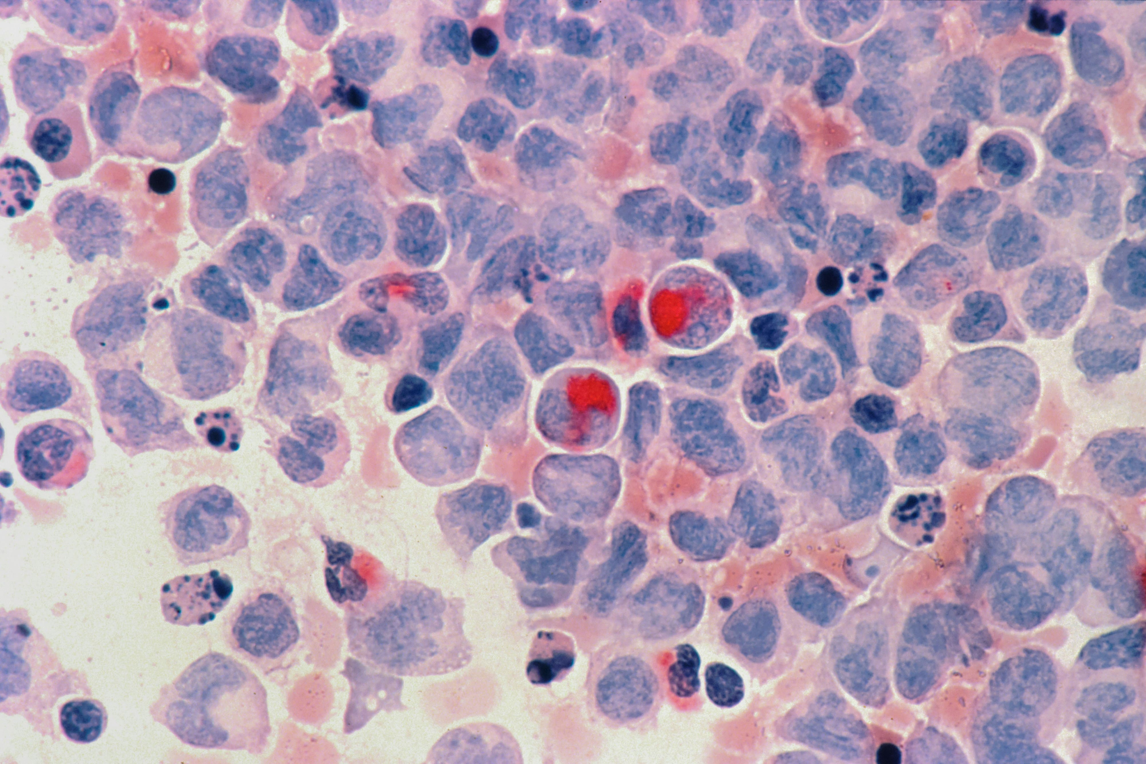 Signs of Cancer in Women You Shouldn’t Ignore - BERITAJA